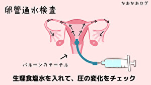 卵管通水検査の図